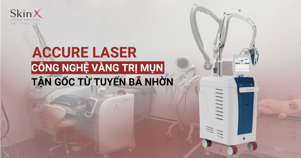 Accure Laser: Công nghệ vàng trị mụn tận gốc từ tuyến bã nhờn